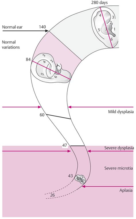 Disorders of the External Ear | Ento Key