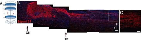 Induced Pluripotent Stem Cells Derived Motor Neurons Mns Survive