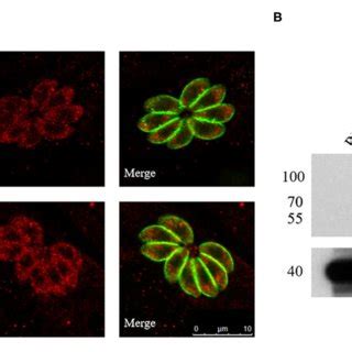 Immunofluorescence Analysis And Western Blotting Of CTrp26 And CTrx1