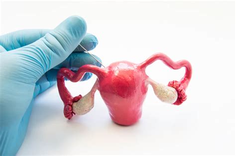 ENDOMETRIAL BIOPSY