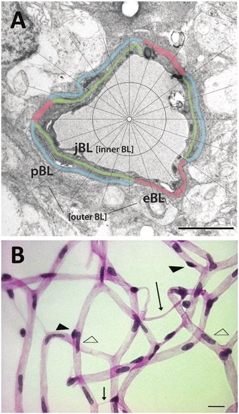 A Electron Micrograph Of A Retinal Capillary Analyzed For Basal Download Scientific Diagram