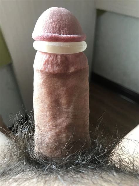 Put A Rubber Ring On The Glans Nude Pics Xhamster