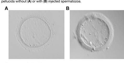 Figure 1 from Evaluation of human sperm function after being ...