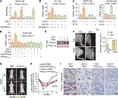 DLC1 Inhibits Bone Metastasis By Regulating PTHLH Expression A