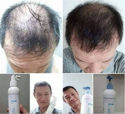 Atomy Shampoo | Cilt bakımı, Cilt, Sağlık