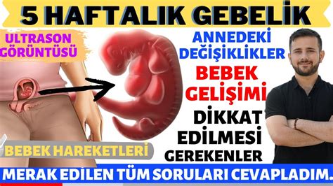 5 Haftalık Gebelik 2023 YouTube