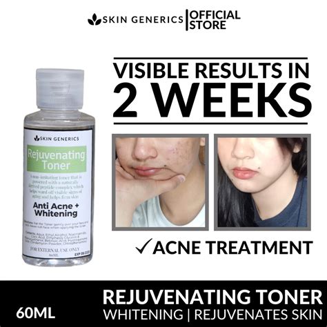 [ Anti Acne Anti Dark Spot Toner ] Skingenerics Rejuvenating Toner