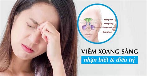 Viêm xoang sàng trước sau là gì Triệu chứng và cách điều trị