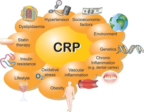 Xét nghiệm CRP làm gì bao nhiêu là bình thường dương tính