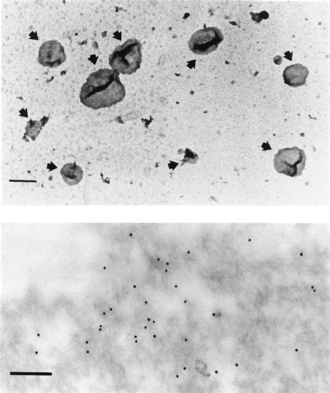 Electron Microscopic Analysis Of Purified Recombinant Caveolin Rich