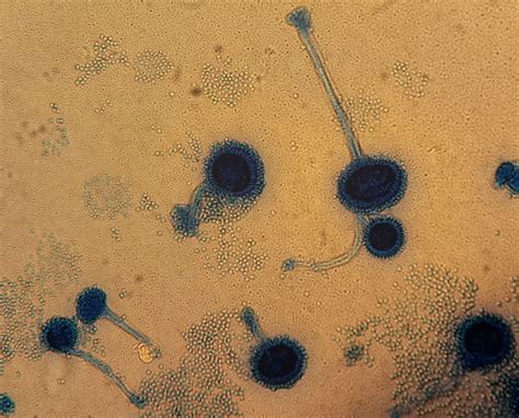 Aspergillus Fumigatus Mikroskopie Doccheck