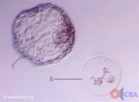 Hatched Blastocyst 