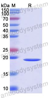 Buy Recombinant Human TMX2, N-His