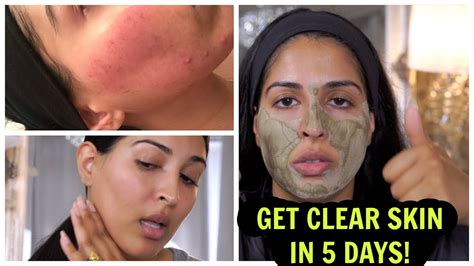 These Before And After Photos Show How A Clay Mask Can