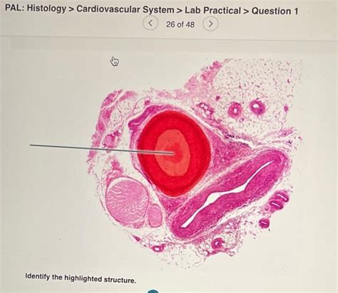 Solved Pal Histology Cardiovascular System Lab Chegg