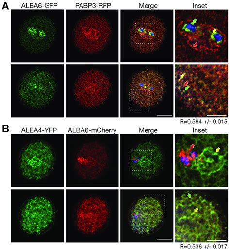 Co Localization Analysis Of Alba A Confocal Microscopy Of Cells