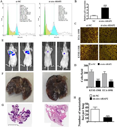 Knockdown Of Circ ARAP2 Suppressed ESCC Metastasis A Representative