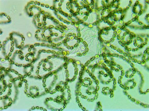 Cyanobacteria-Under-Microscope | Acton Wakefield Watersheds Alliance