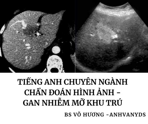 Hình Ảnh Gan Nhiễm Mỡ Triệu Chứng Nguyên Nhân và Phương Pháp Điều Trị