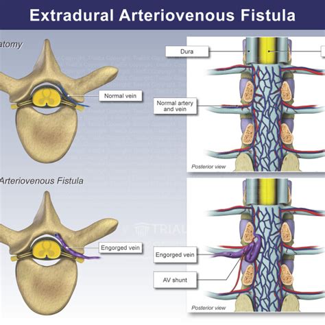 Organo Axial Volvulus Of The Stomach Trial Exhibits Inc