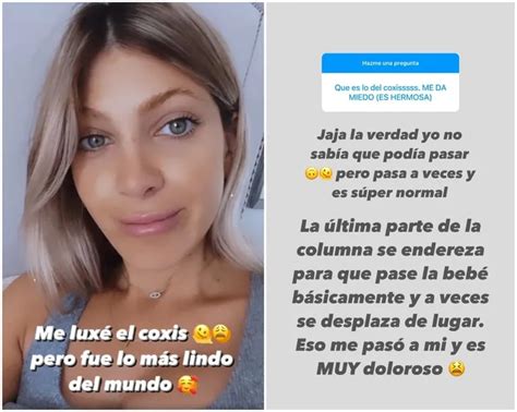 Cande Ruggeri contó la lesión que sufrió durante el nacimiento de su