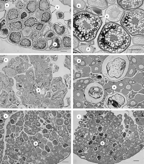 Photomicrographs Of Gonadal Tissue From Female Ruffe In Advanced