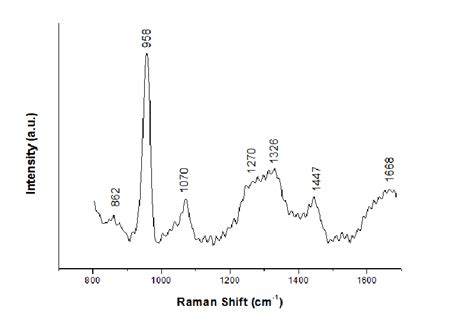 Typical Raman Spectra Of Bone Components Showing The Their Main Shifts