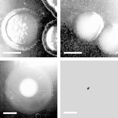 Light Microscopy Of Zones Of Twitching Motility A And B Show