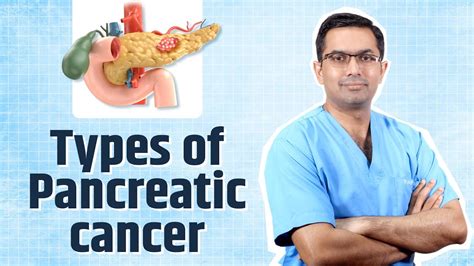 Types Of Pancreatic Cancer Youtube