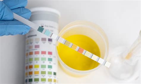 How To Read A Drug Test Panel Drug Test Cups