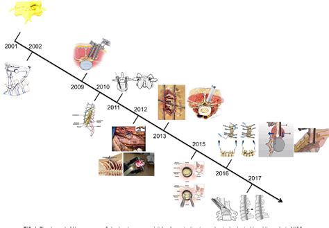 Figure From The Evolution Of Minimally Invasive Spine Surgery