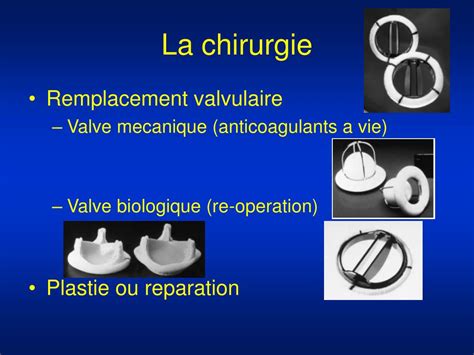 PPT La Chirurgie Cardiovasculaire PowerPoint Presentation Free