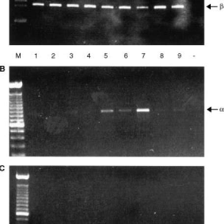 Detection Of Oestrogen Receptor Mrnas By Rtpcr A Er B Er C