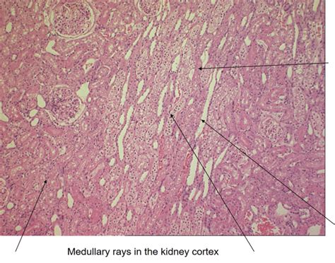 Histology: Medullary Rays — Printable Worksheet