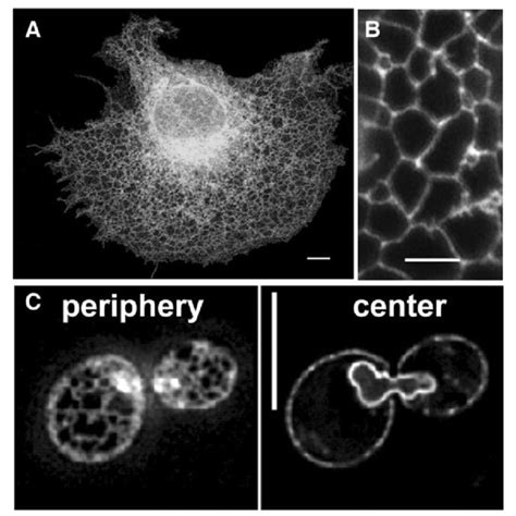 Lysosome Morphology In Mouse Bone Marrow Macrophages Mouse Bone Marrow