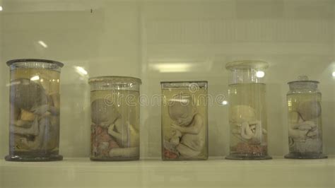 Anatomical Human Specimens In Formalin Editorial Photography Image Of Laboratory Glass 108299022