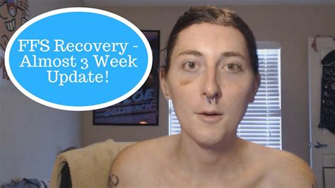 FFS Post Op Recovery Update Almost 3 Weeks MTF Transgender