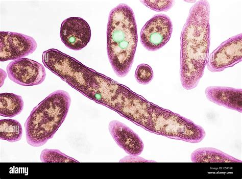 Transmission Electron Micrograph Tem Of Legionella Pneumophila The