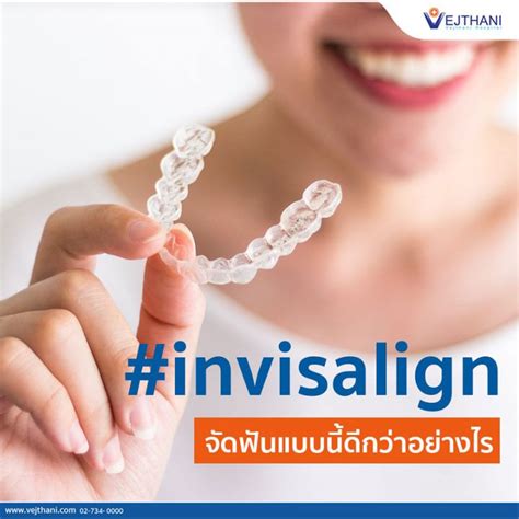 Invisalign คืออะไร โรงพยาบาลเวชธานี