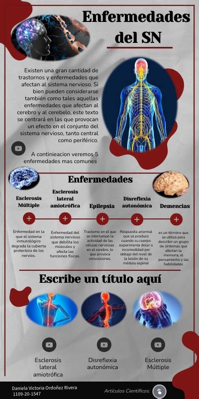 Infograf A De Enfermedades Del Sn