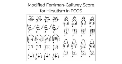 Pcos Hirsutism Excess Hair Growth Causes And Treatments The Pcos