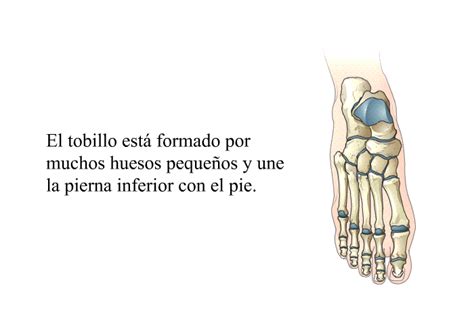 Patedu Fracturas Y Torceduras Y Sus Opciones De Tratamiento