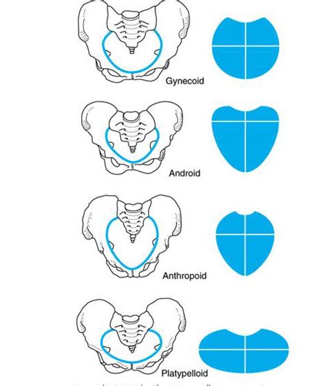 Types Of Pelvis