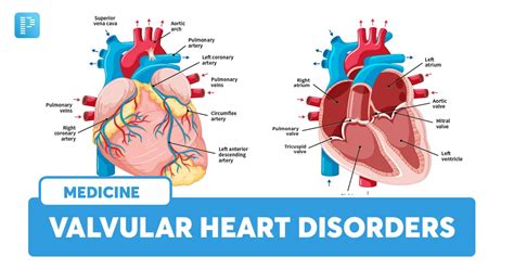 Valvular Heart Disease Types Causes Symptoms And Diagnosis