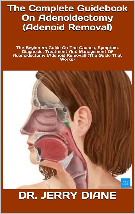 Buy The Complete Guidebook On Adenoidectomy Adenoid Removal The