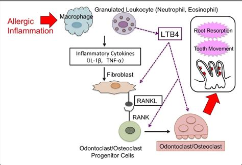 Figure 1 from Tooth root resorption: A review | Semantic Scholar