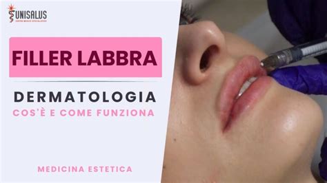 Guida completa al filler labbra cos è e come funziona Actualizado