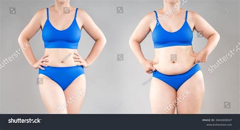 Woman S Body Before And After Weight Loss Or Royalty Free Stock Photo