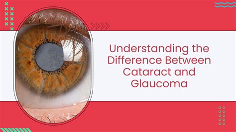 Understanding The Difference Between Cataract And Glaucoma