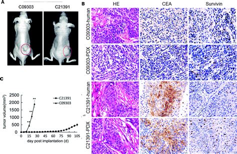 Patient Derived Bladder Cancer Xenograft Models Reveal Vegf And Cdk